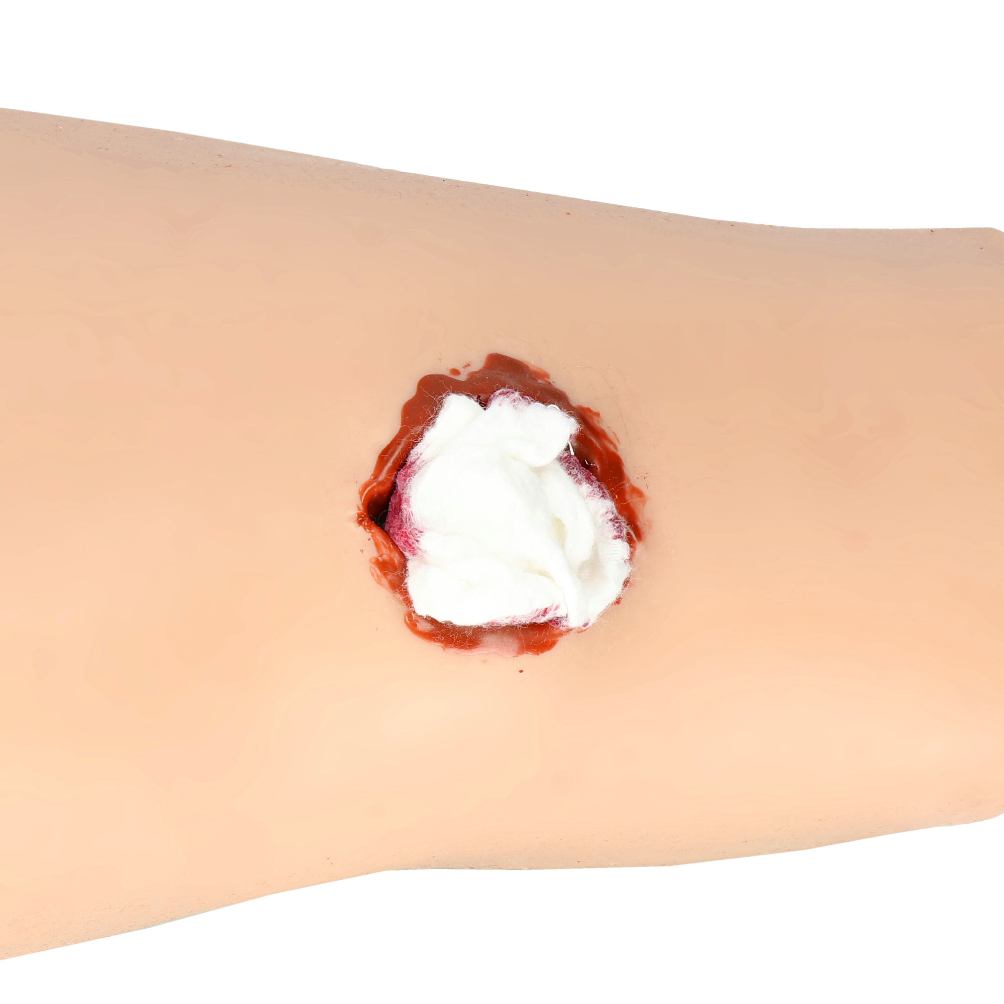 A.C.T. Bandage rana wypełniona modułem wound packing
