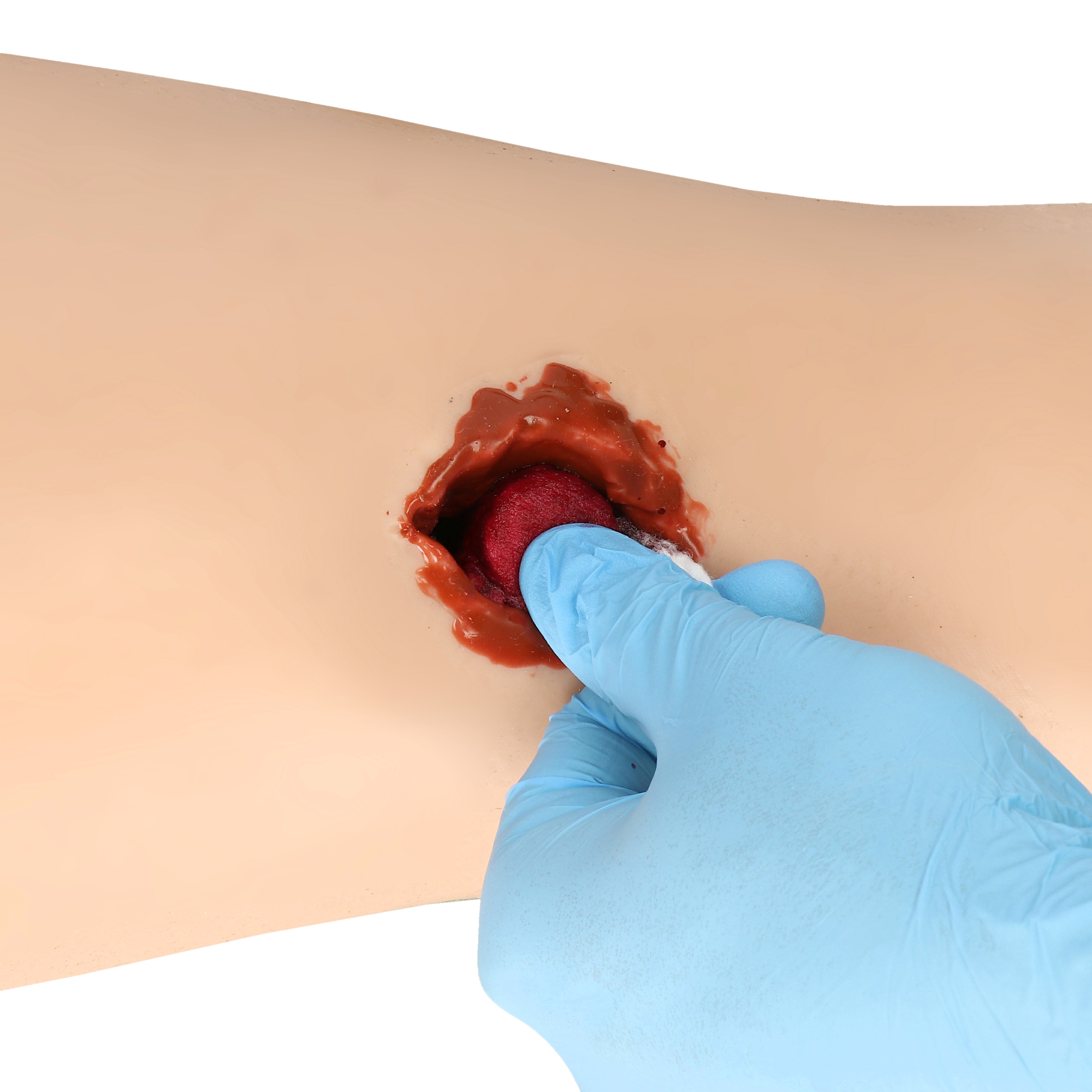 A.C.T. Bandage wprowadzanie modułu wound packing do rany