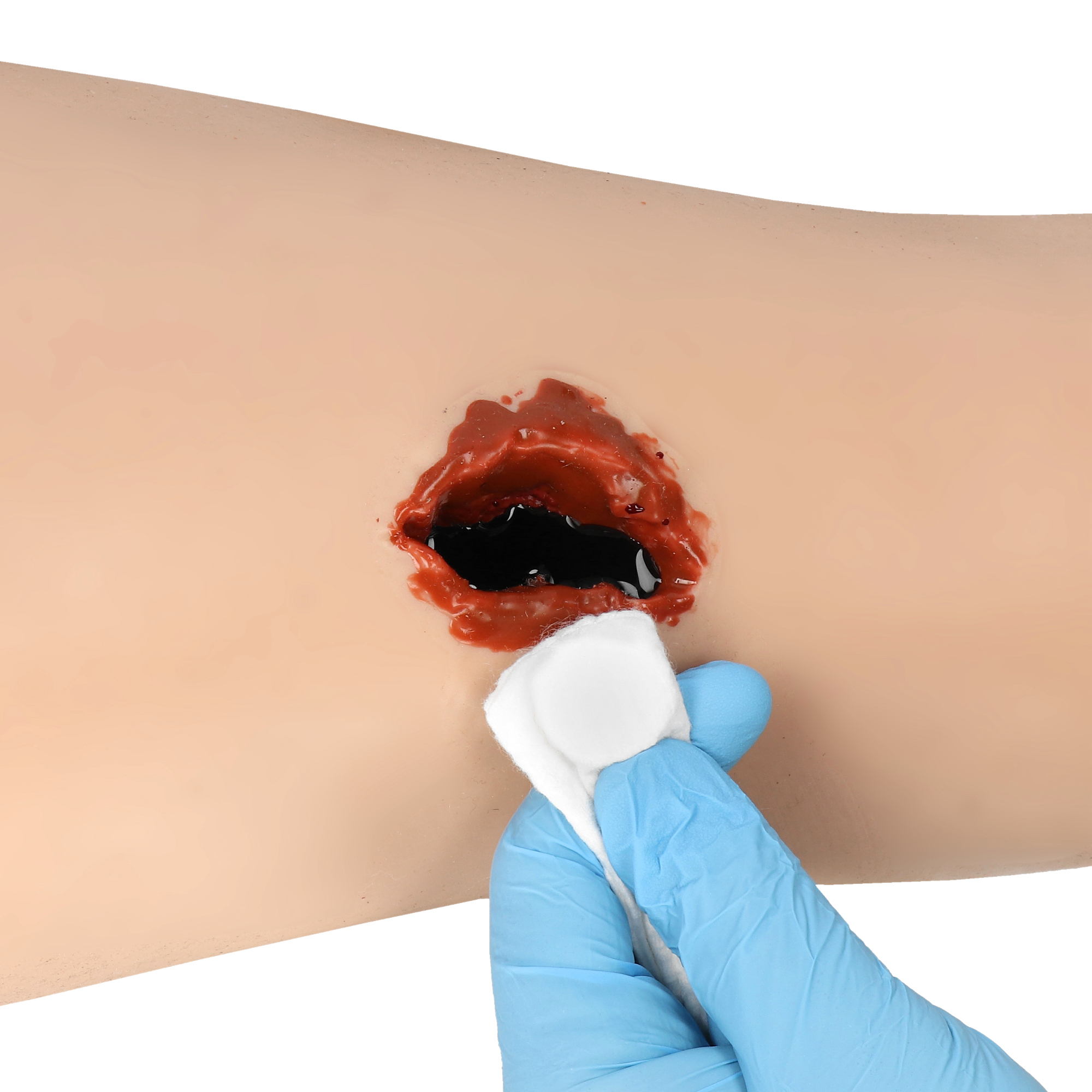 A.C.T. Bandage ocena głębokości rany przed pakowaniem wound packing